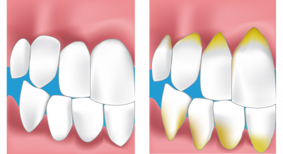 dentiste zian tours